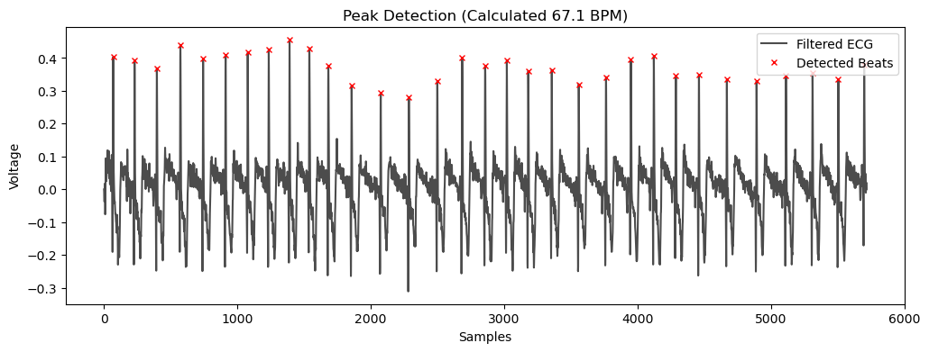 Automated peak detection algorithm calculating beats per minute from a filtered human ECG signal